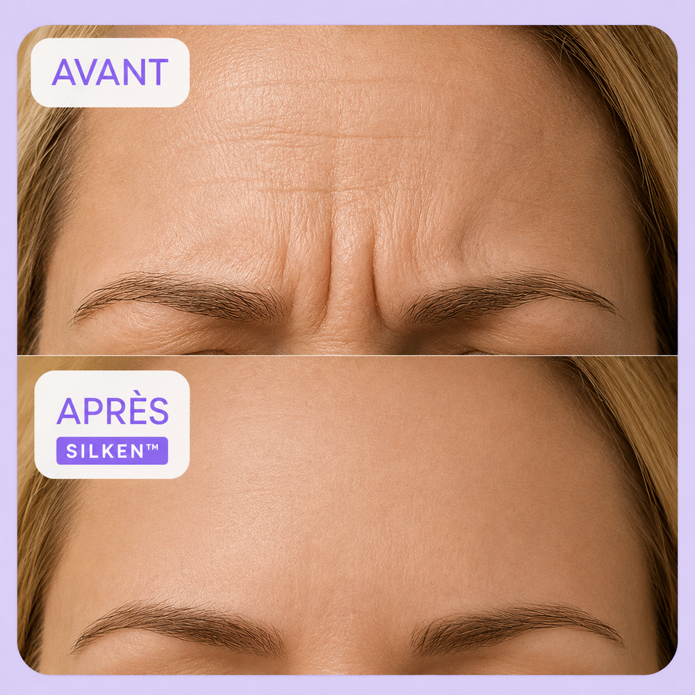 Avant / après